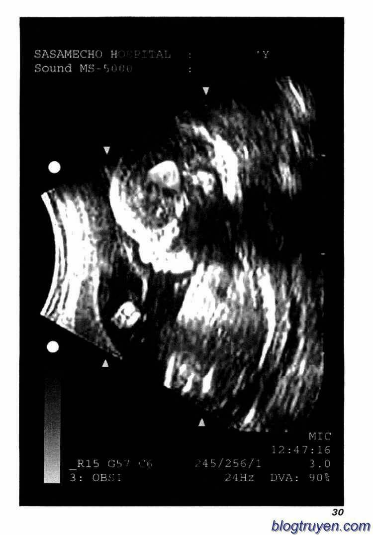 Elfen Lied Chapter 72 - Trang 28