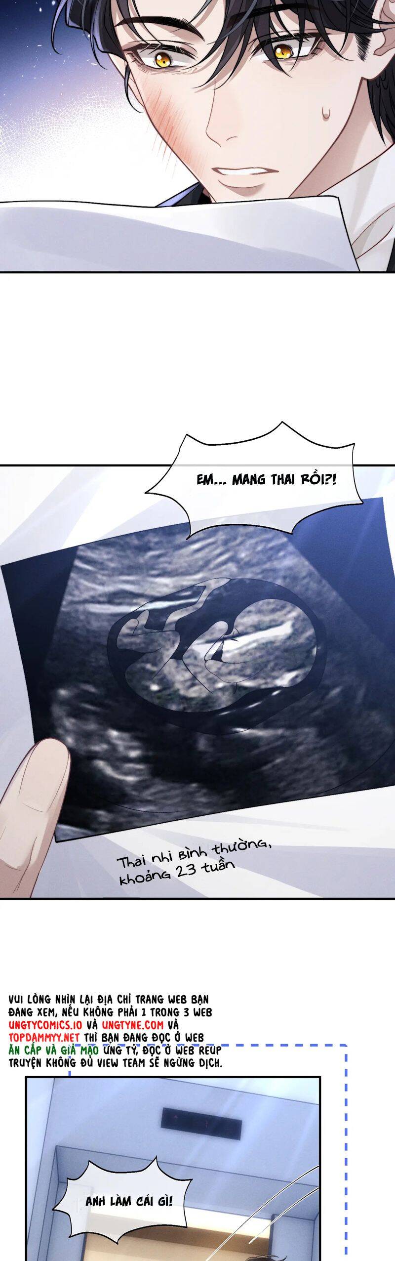 Chấp Sự Thỏ Cụp Tai - Chapter 130 - Page 19