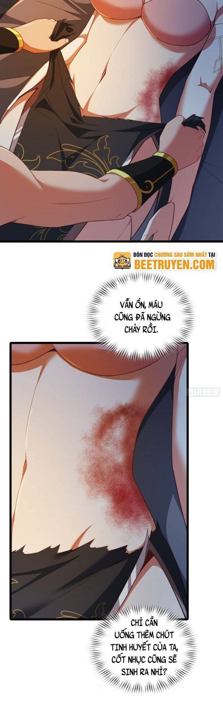 Xuyên Qua Thành Npc Xui Xẻo: Ta Có Lão Bà Che Chở - Chapter 80 - Page 7