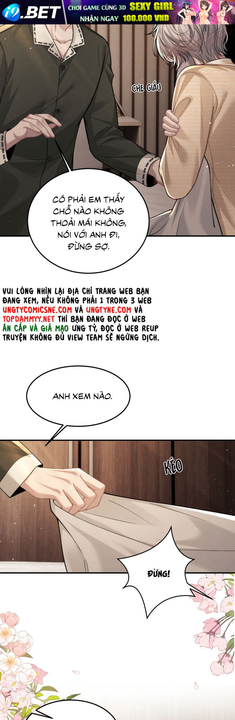 Chấp Sự Thỏ Cụp Tai - Chapter 157 - Page 17