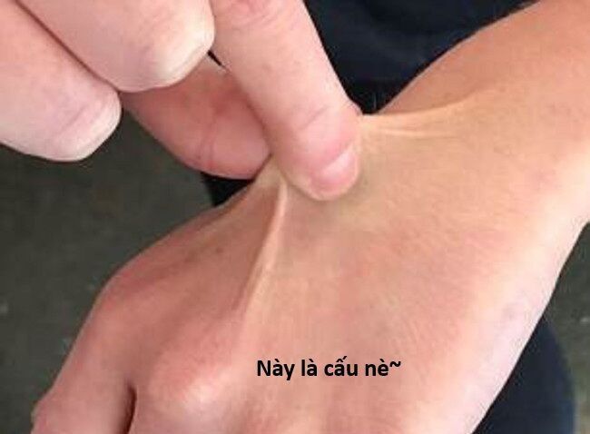 Hổ Đến Chơi Nhà - Chapter 144 - Page 63