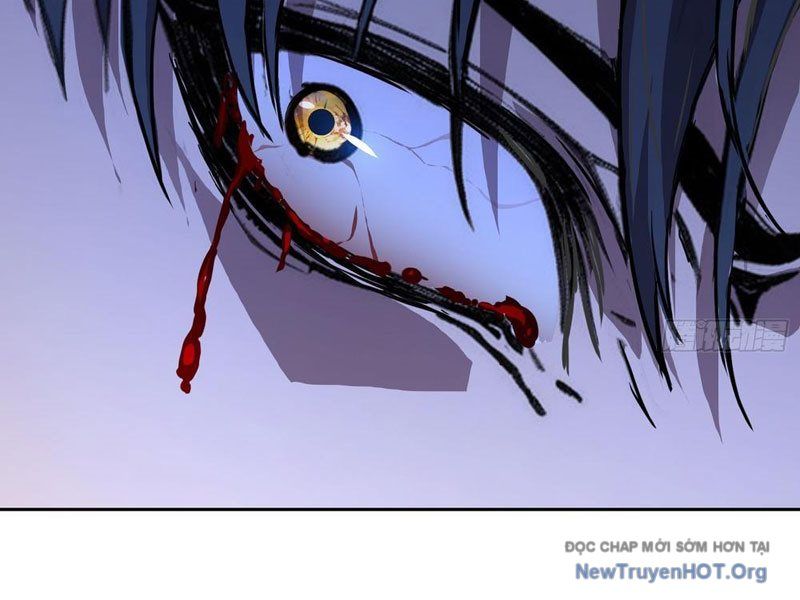 Thế Giới Toàn Người Điên, Tỉnh Táo Chính Là Bị Bệnh - Chapter 6 - Page 125