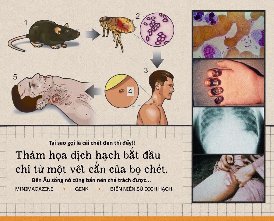 Hổ Đến Chơi Nhà - Chapter 156 - Page 17